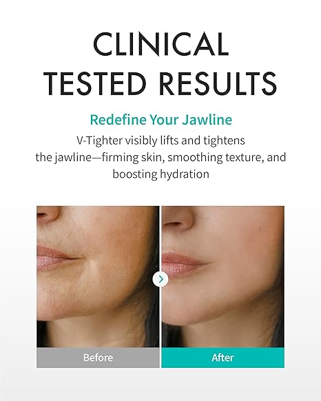 REJURAN Perfect V Tighter Dual-Sheet Lifting Sheet Mask, c-PDRN(4ea) – Face & Jawline
