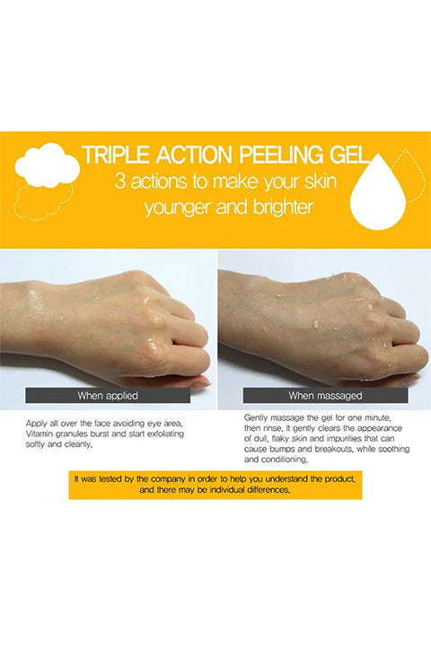 IASO Triple Action White Peeling Gel