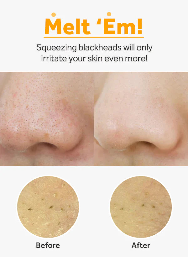 ma:nyo Pure Cleansing Oil