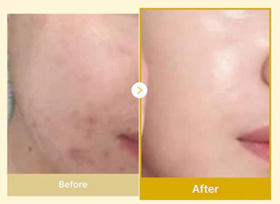 medicube Kojic Acid Turmeric Night Wrapping Mask